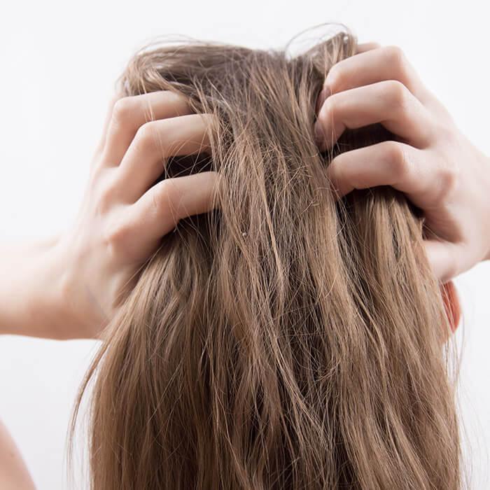 how-to-get-rid-of-dandruff-thumbnail