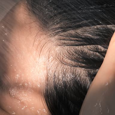 best-scalp-treatments-thumbnail