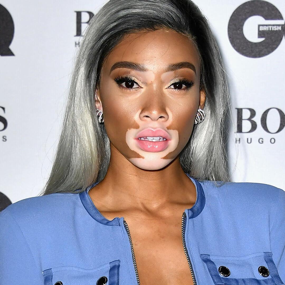 A photo of Winnie Harlow with platinum gray hair