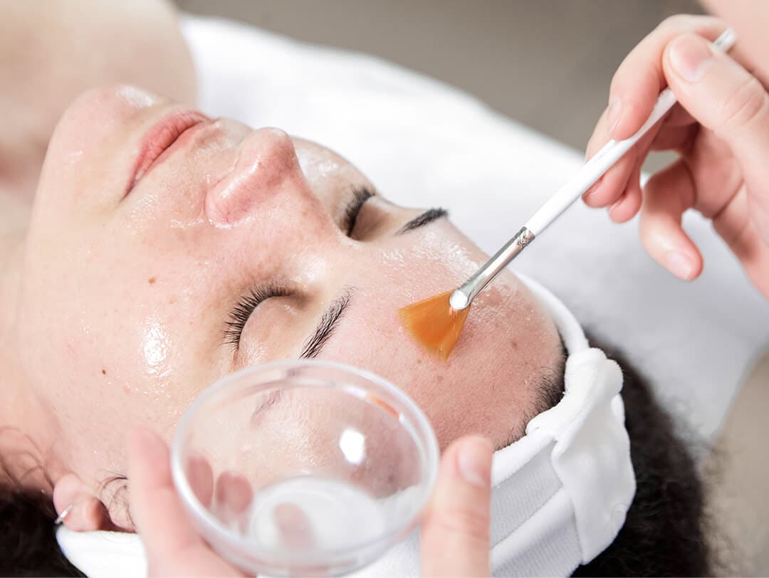 Glycolic Acid Peel 101 What You Need To Know Beforehand