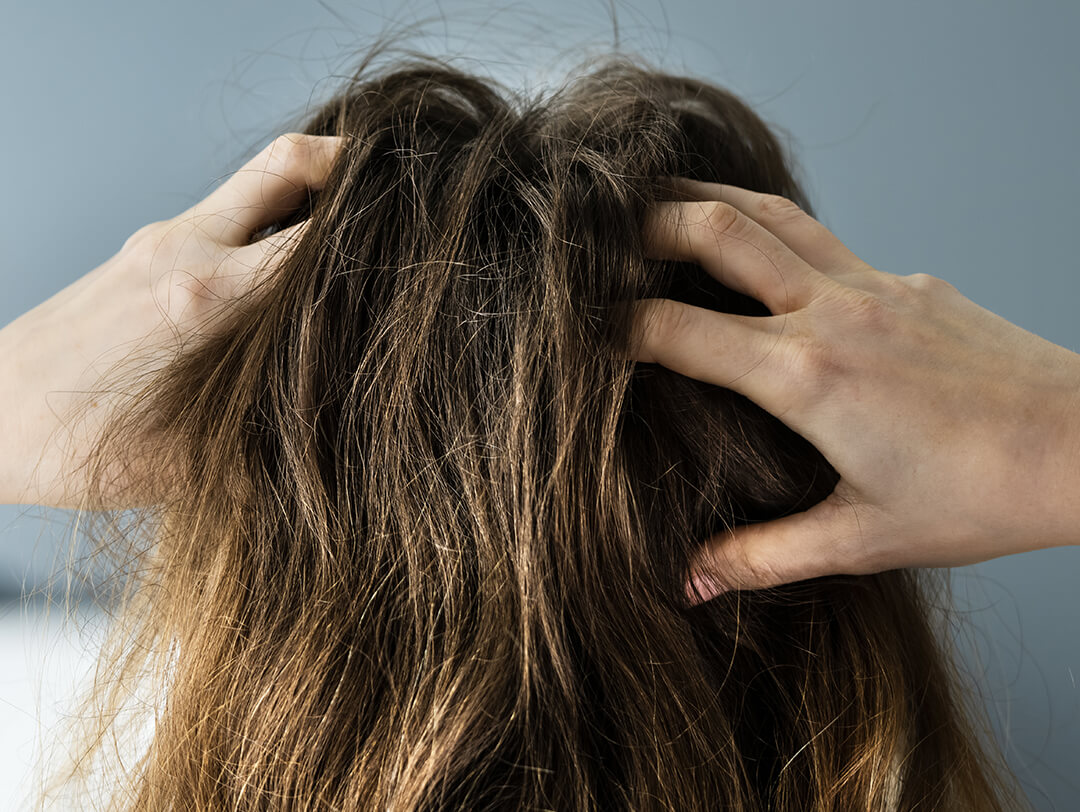 Dry Scalp Treatments and Tips From Trichologist | IPSY