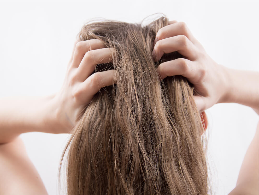 Itchy Scalp Treatment: Best Products and Home Remedies | IPSY