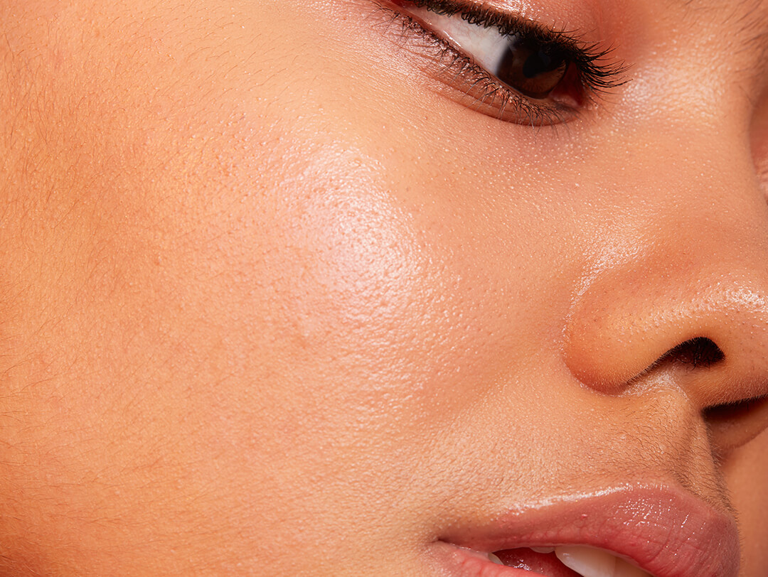 Benzoyl Peroxide vs Salicylic Acid What’s the Difference?